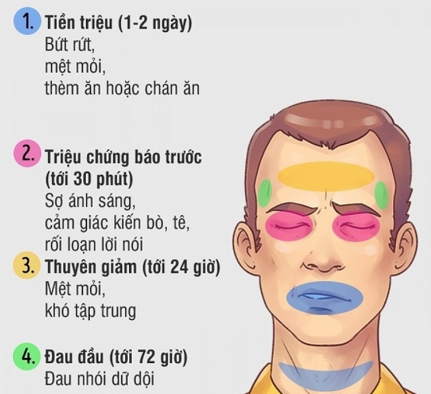 Hướng dẫn cách phân biệt đau nửa đầu và đột quỵ chuẩn bác sĩ chuyên khoa