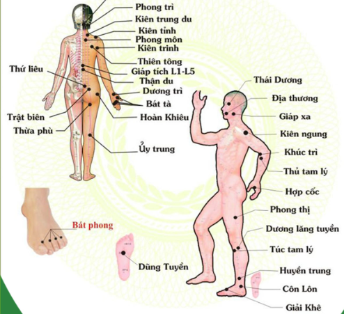 Châm cứu hỗ trợ phục hồi sau tai biến mạch máu não và những điều cần biết