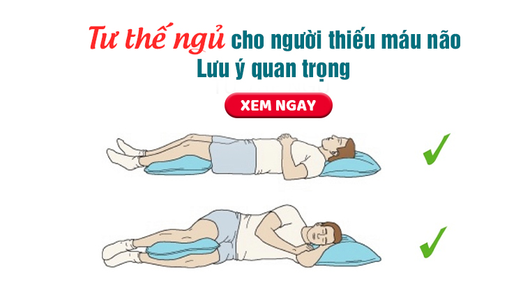 Tư thế ngủ cho người thiếu máu não: Áp dụng ngay để cải thiện sức khỏe