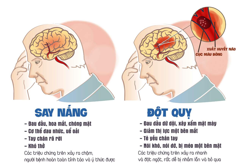 Đột quỵ mùa nắng nóng: Làm thế nào để phòng tránh?