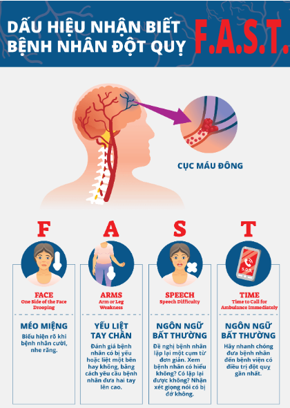 Tai biến mạch máu não lần 2: Mối nguy hiểm đe dọa tính mạng