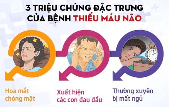 Thiếu máu não mạn tính: Nguy cơ đột quỵ nếu không được nhận biết kịp thời