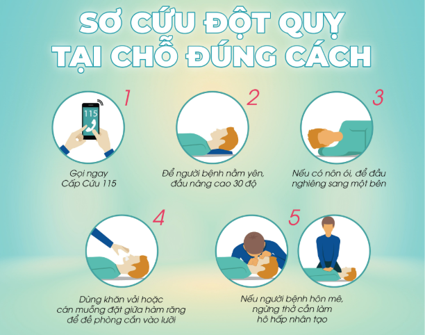Cách sơ cứu tai biến mạch máu não tại nhà: Việc đơn giản nhưng có thể cứu sống một mạng người