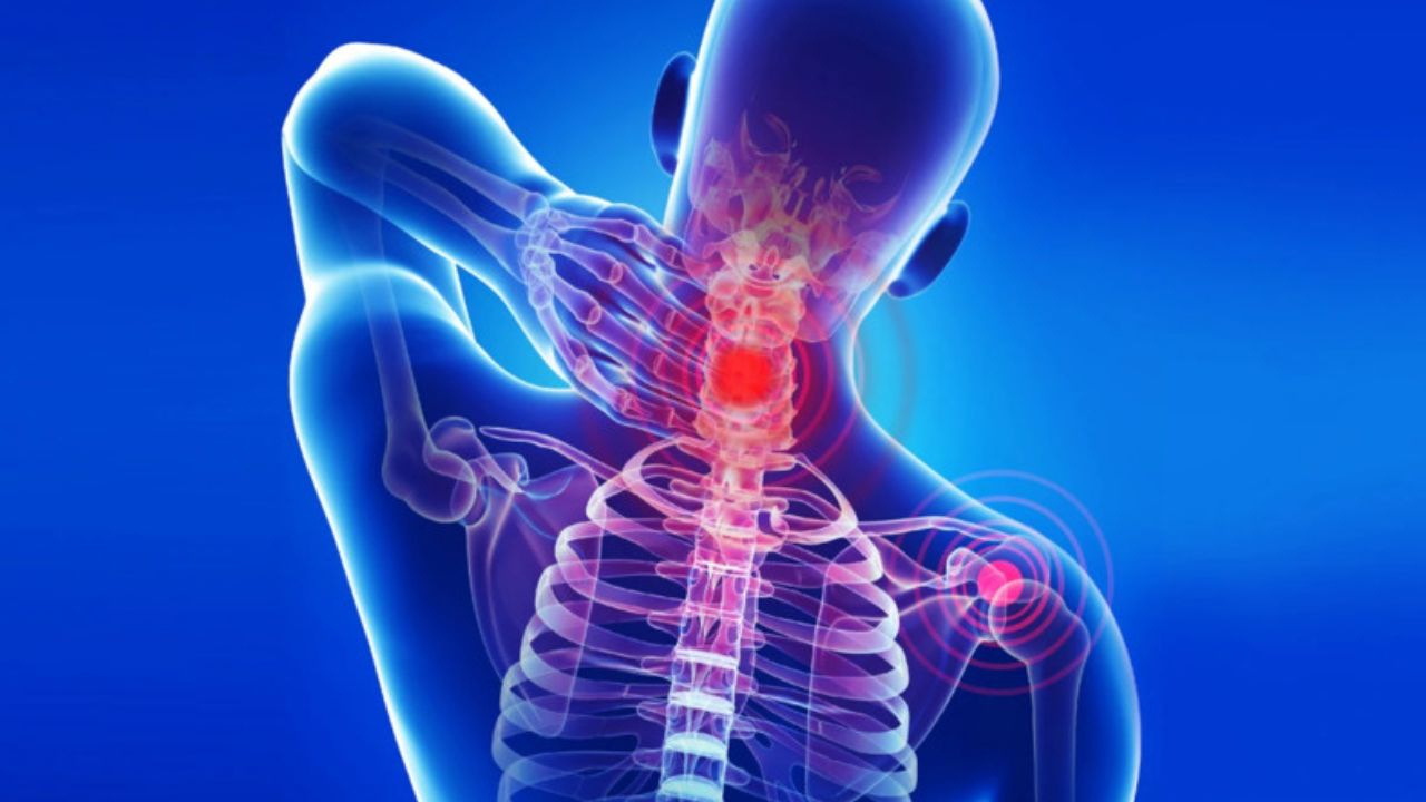 Thiếu máu não do thoái hóa đốt sống cổ - Làm sao để cải thiện nhanh chóng?