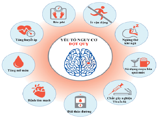 Top đối tượng có nguy cơ cao bị đột quỵ não – Bạn có đang thuộc nhóm này?