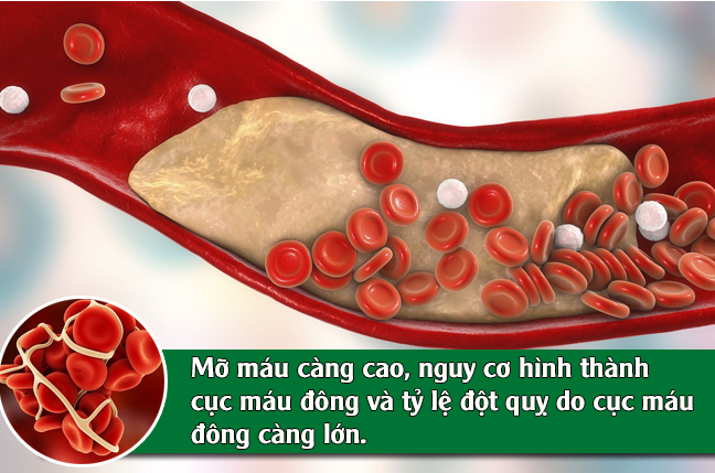 Top bệnh nền tăng nguy cơ đột quỵ: Bạn có đang mắc phải những căn bệnh này?